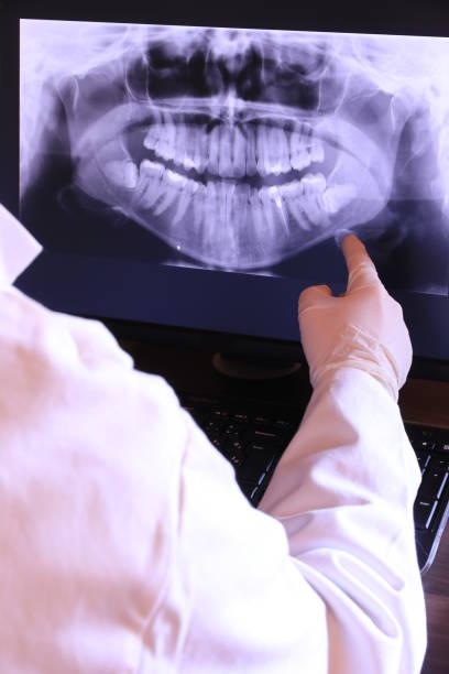 Best Emergency Root Canal Treatment in Mauriceville, TX