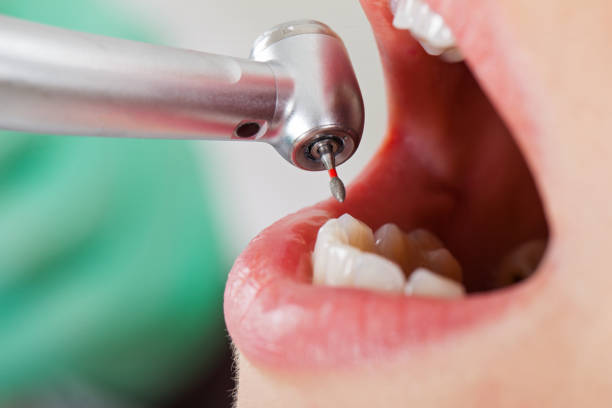 Best Broken or Cracked Tooth Emergency Dentist in Mauriceville, TX